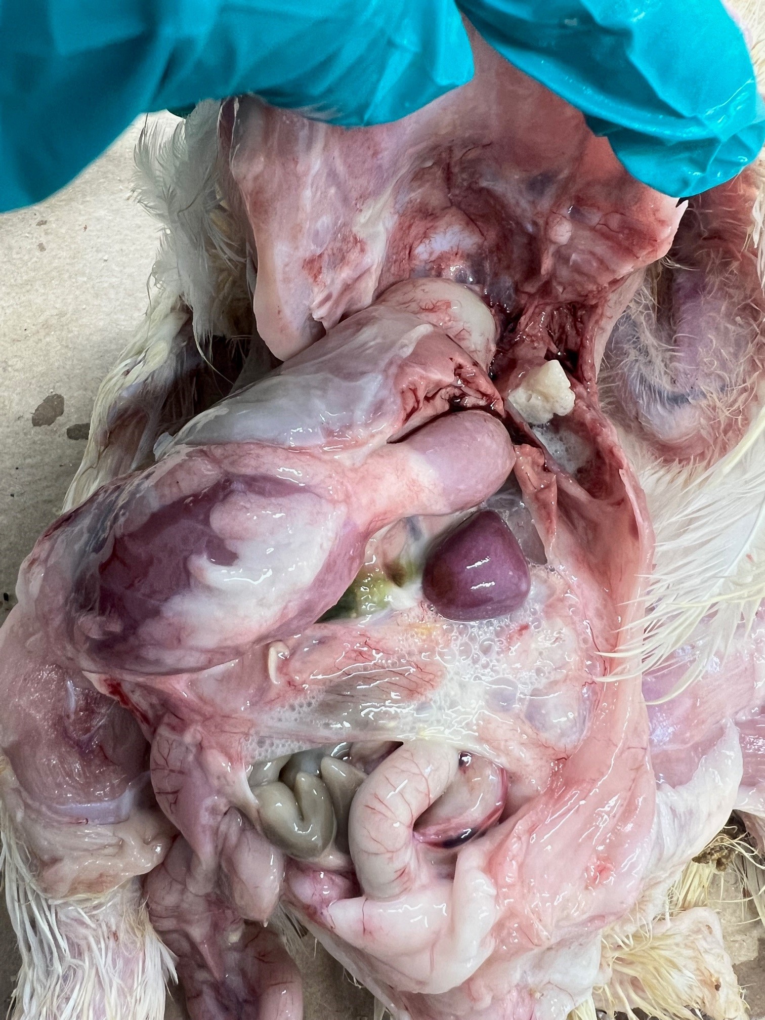 Bildet vise perikarditt, perihepatitt og luftsekkbetennelse, legg også merke til den forstørrede milten. Luftsekkene er blakket og med et skummende innhold. Pericardiet er fylt med en osteaktig masse og serøse hinner dekker leveren.