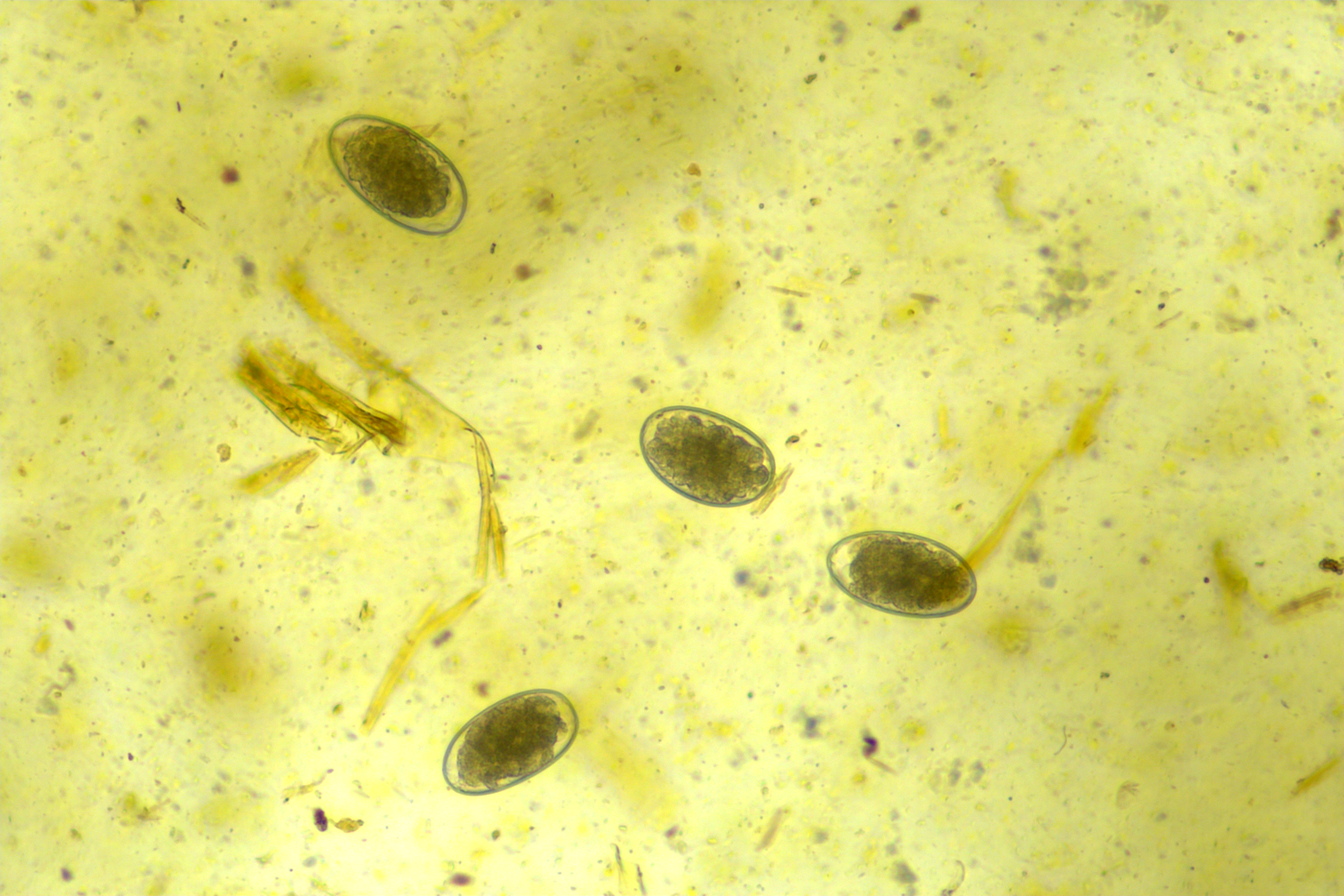 Strongylide egg i mikroskop