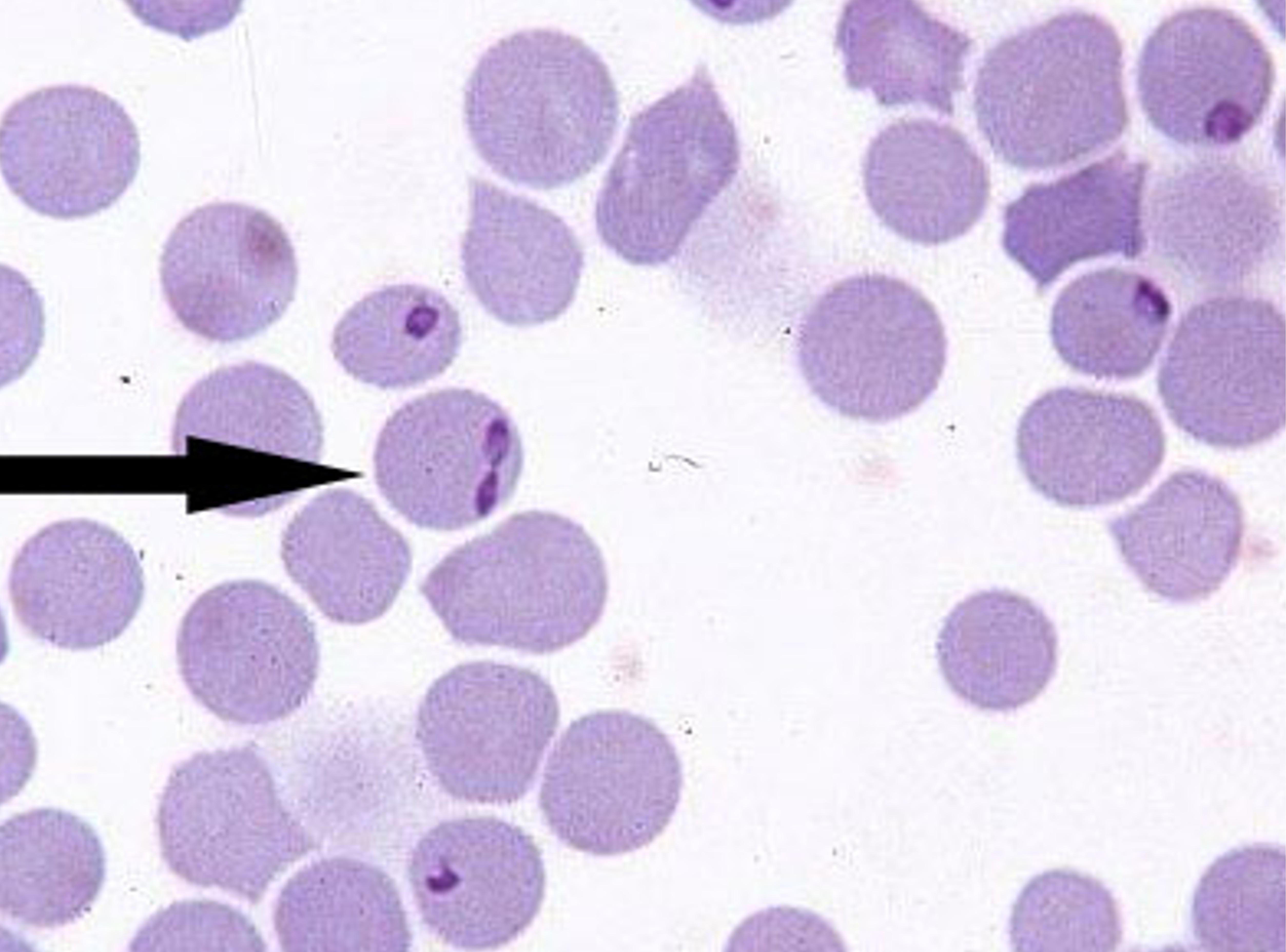 Foto av røde blodceller med parasitten Babesia som repliserer seg inne i blodcellene.