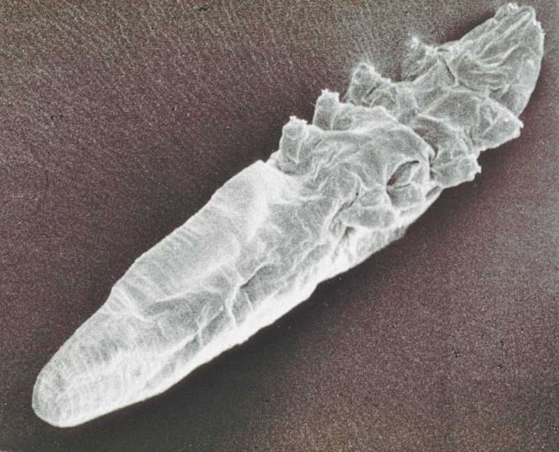 mikroskop bilde Demodex bovis