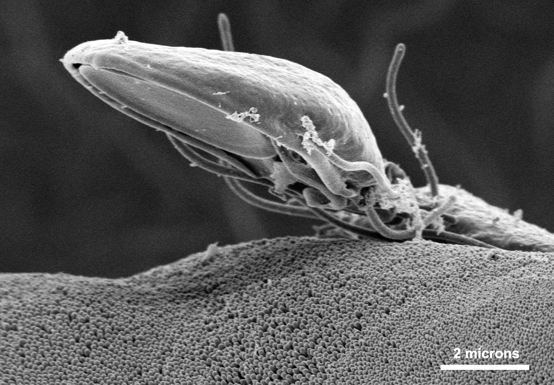 Nærbilde av Giardia som fester seg til tarmepiteliet
