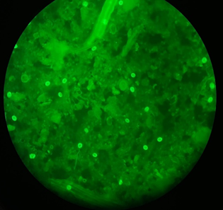 Mikroskopisk bilde av Giardia cyster